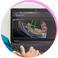 <p>3D-navigierte<br /><br />Implantologie</p><br />